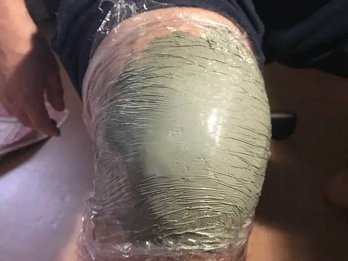 Comment faire un cataplasme d'argile verte sur le genou