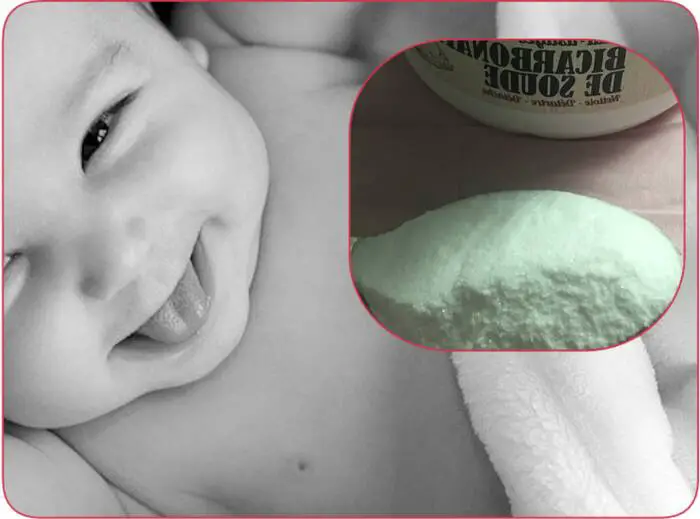 Comment traiter le muguet de bébé avec le bicarbonate de soude