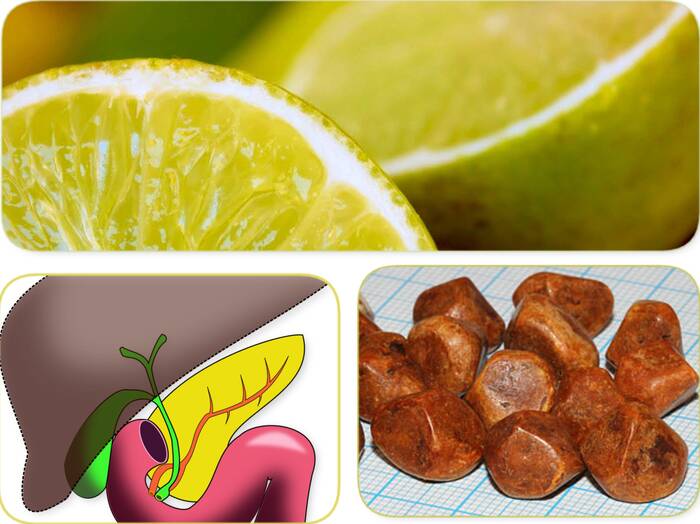 Comment éviter les calculs biliaires avec du citron