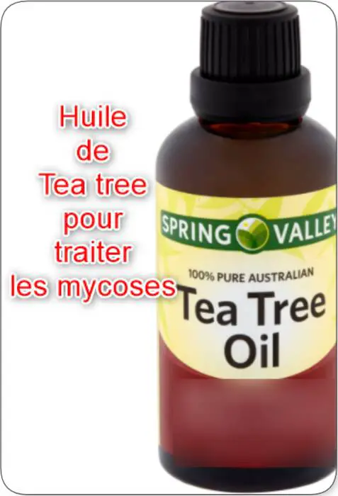 Huile de tea tree pour traiter les mycoses vaginales